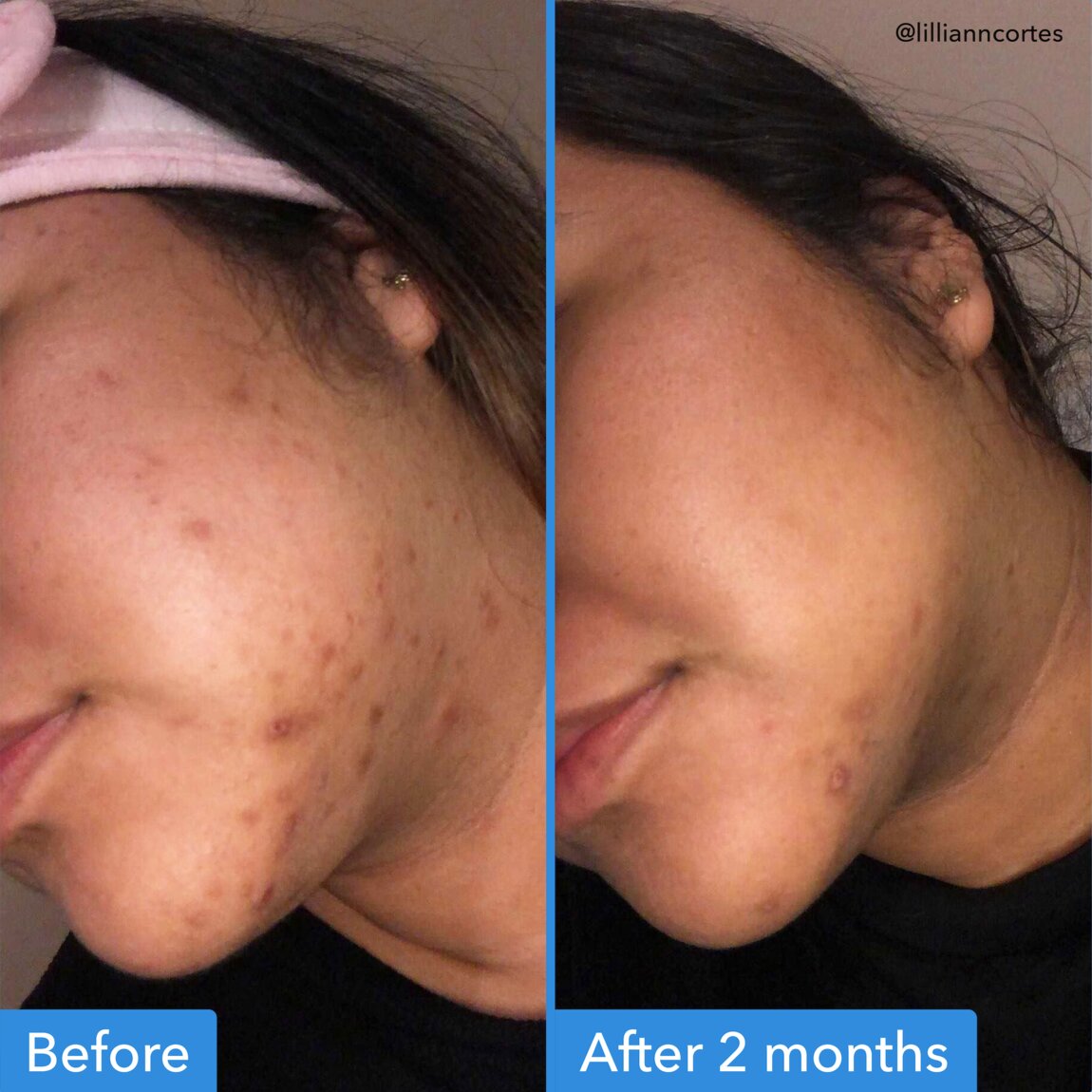 discoloration-correcting-serum-e4 zb_p.jpg