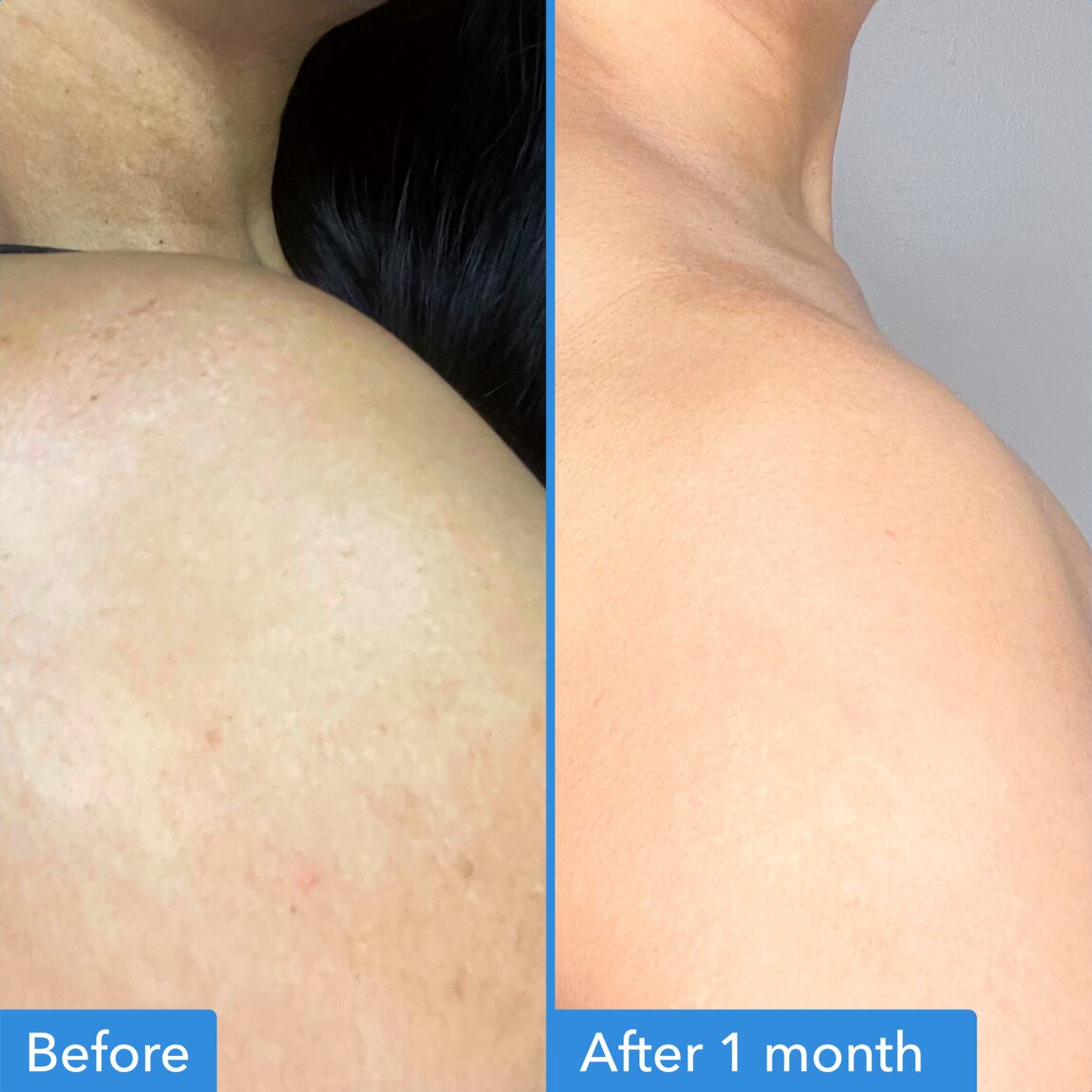 discoloration-correcting-body-treatment-o0 zb_p.jpg
